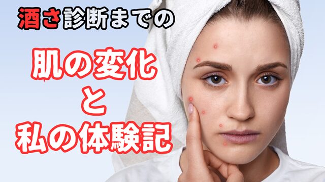 酒さ発症前の肌の赤みとブツブツに悩む女性のイメージ